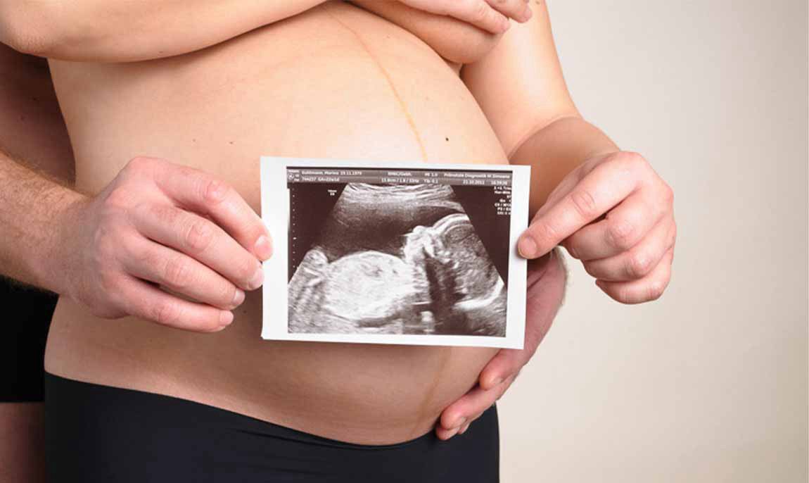 assets/images/activities/kassel-calden-babybauch-fotoshooting/sky-bau-6-1150x686x90.jpg