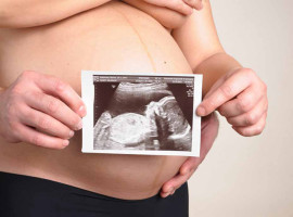 assets/images/activities/kassel-calden-babybauch-fotoshooting/sky-bau-6-270x200x90.jpg